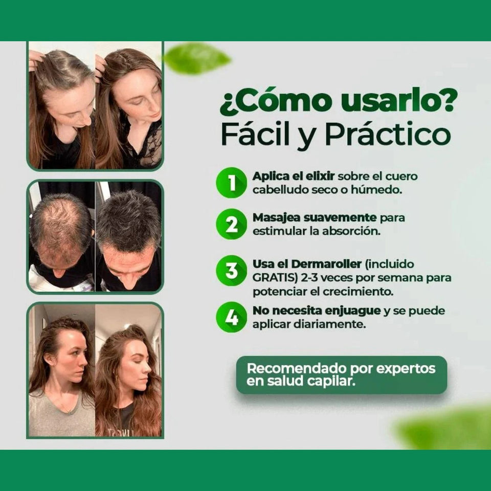 OUHOE - CRECIMIENTO DEL CABELLO